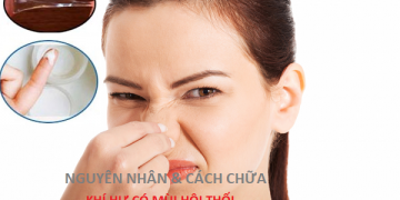 [Bật mí]: Khí hư có mùi hôi nguyên nhân, biểu hiện và cách chữa