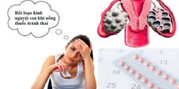 Rối loạn kinh nguyệt sau khi uống thuốc tránh thai