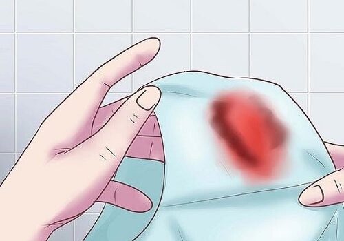 Chảy máu sau quan hệ vài ngày – giải pháp cho mối lo lắng của chị em
