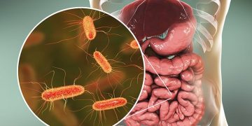 Vi khuẩn e coli: nguyên nhân và cách điều trị