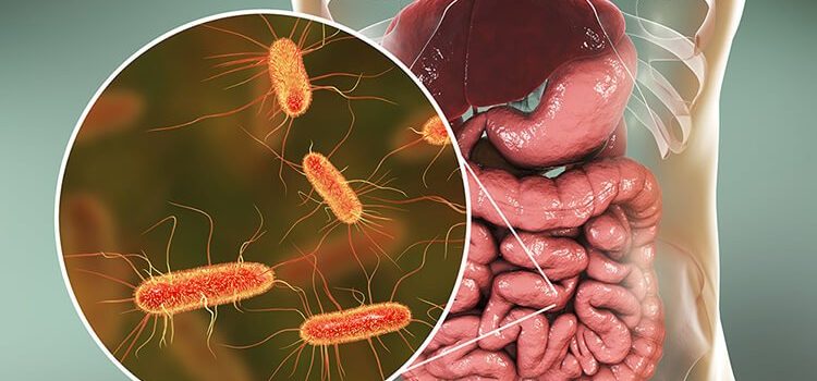 Vi khuẩn e coli: nguyên nhân và cách điều trị